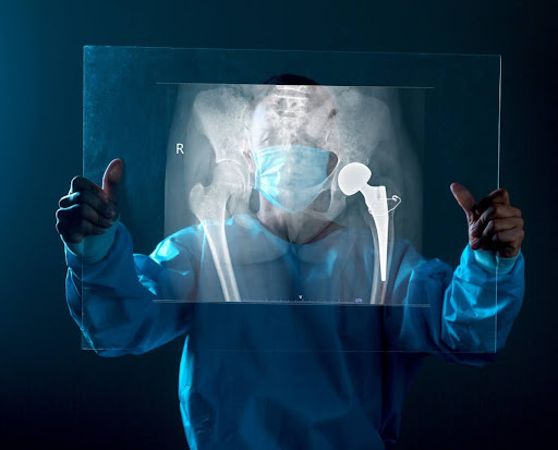 Doctor checking out a patient's hip x-ray